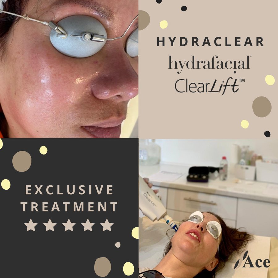 Ace Aesthetics - Ace Aesthetics